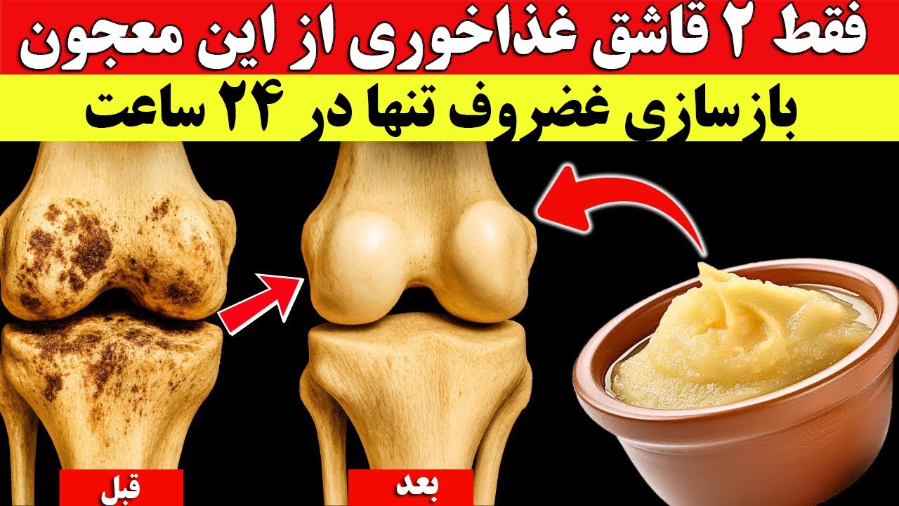 متخصص ارتوپد این ترفند را پیدا کرد آسیب غضروف را فقط در ۲۴ ساعت به طور طبیعی ترمیم کنید