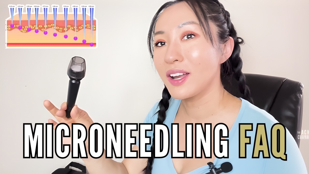 Every Question You May Have About Microneedling ANSWERED - Microneedling FAQ