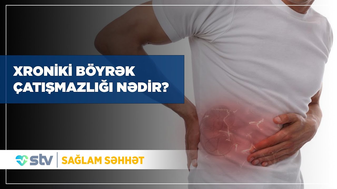 Xroniki böyrək çatışmazlığı və onun müalicəsi - (28.01.2025)