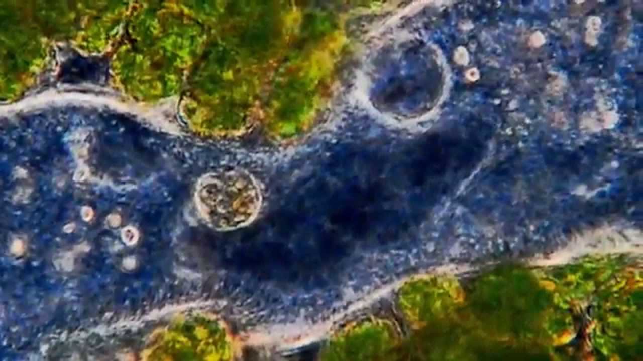 Amazing Microscopic HD Video! Morbidly Obese Paramecium Too Fat To Fit! 1080p