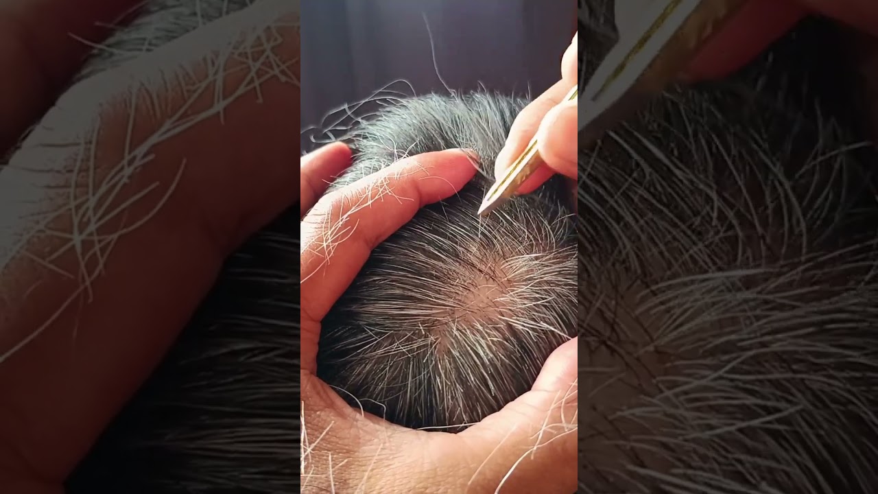 Most satisfying white hair removal#42#musicbackground #satisfying