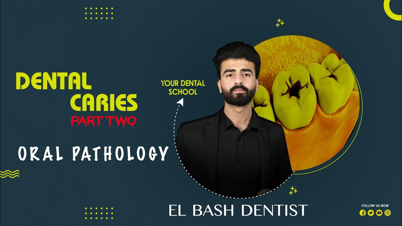 dental caries | part 2 | oral pathology _ عزت شومان