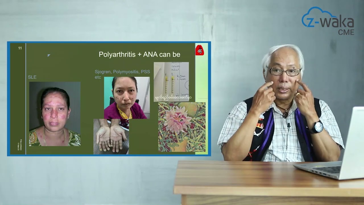 Great confusion of Polyarthritis (Lay-phat-nar)