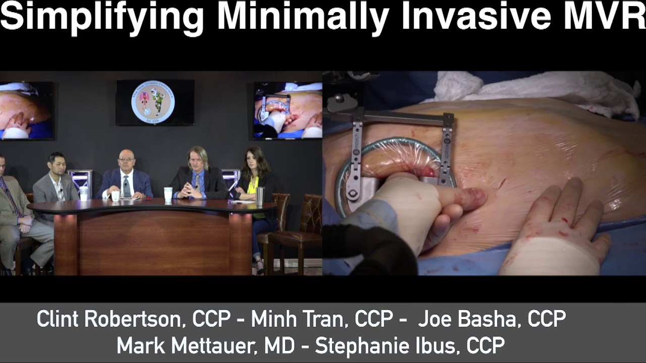 Simplifying Minimally Invasive MVR, Round Table Discussion New Technics In Heart Surgery - overview
