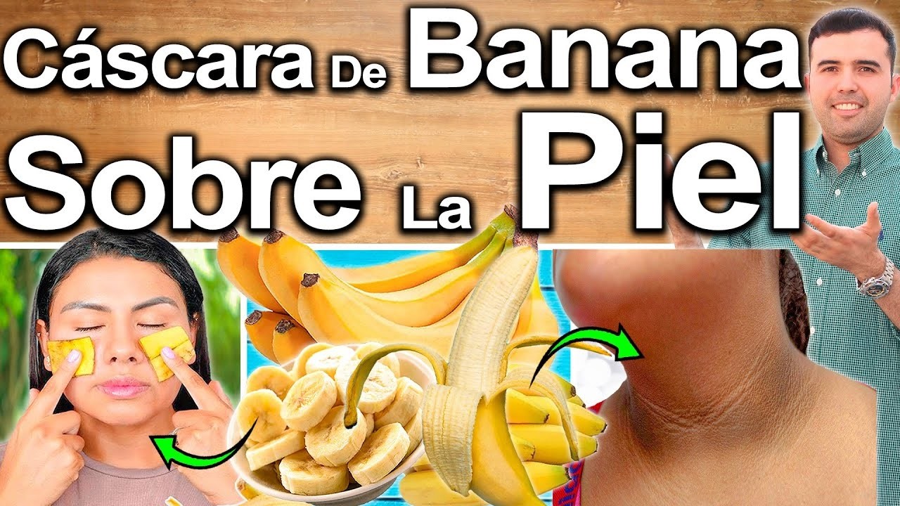CÁSCARA DE BANANA SOBRE LA PIEL TODOS LOS DÍAS - Para Qué Sirve Y Beneficios