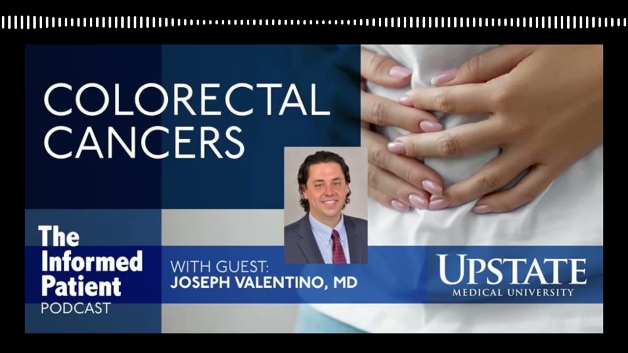 Colonoscopy screens for colorectal cancers, which are affecting more young people