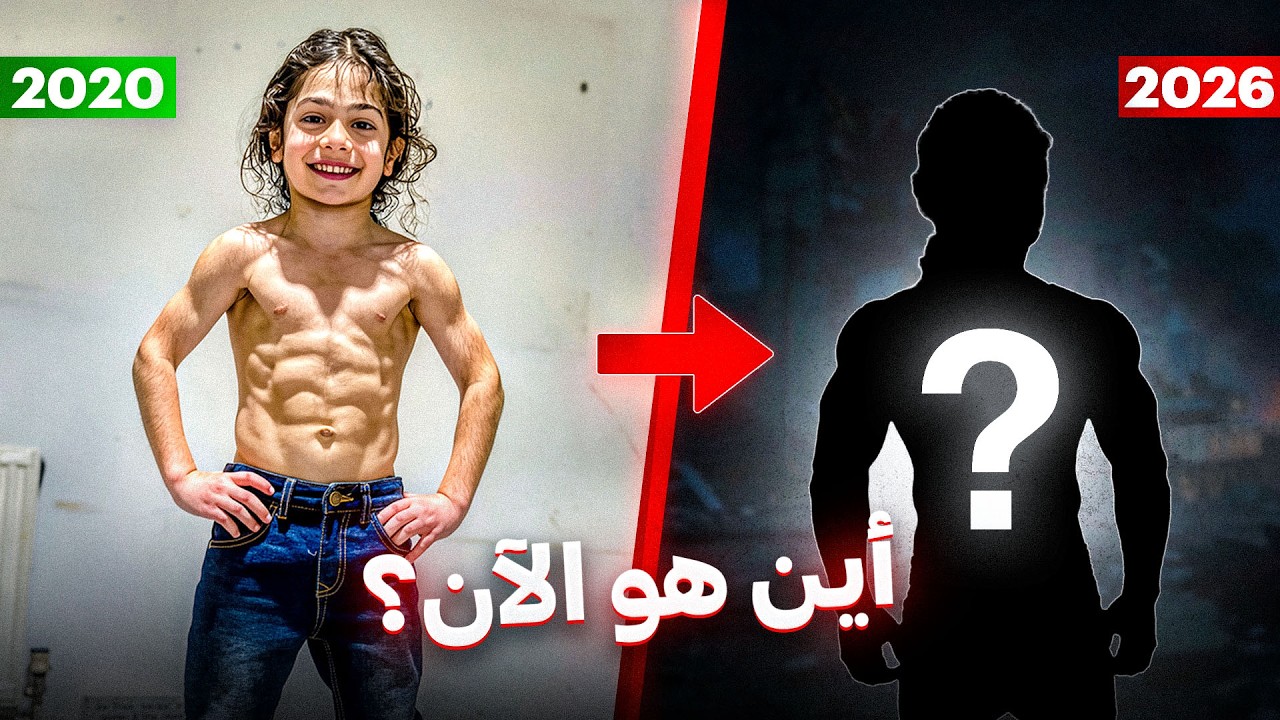 لن تصدق ماذا حدث للطفل المعجزة أرات حسيني وأين هو الآن ؟ 💔