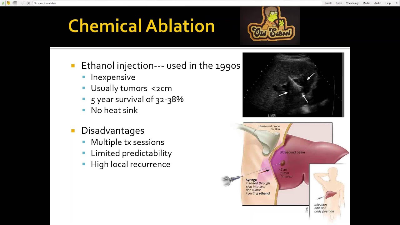 2015 AOCR Radiology Case Review: Interventional Oncology