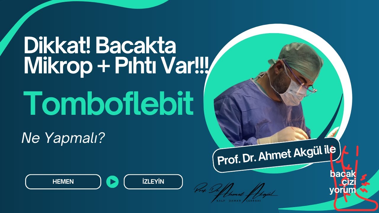 Bacak Damar Tıkanıklığı ve Tromboflebit: Damar Çıkarılması Gerekir mi? - Prof. Dr. Ahmet AKGÜL