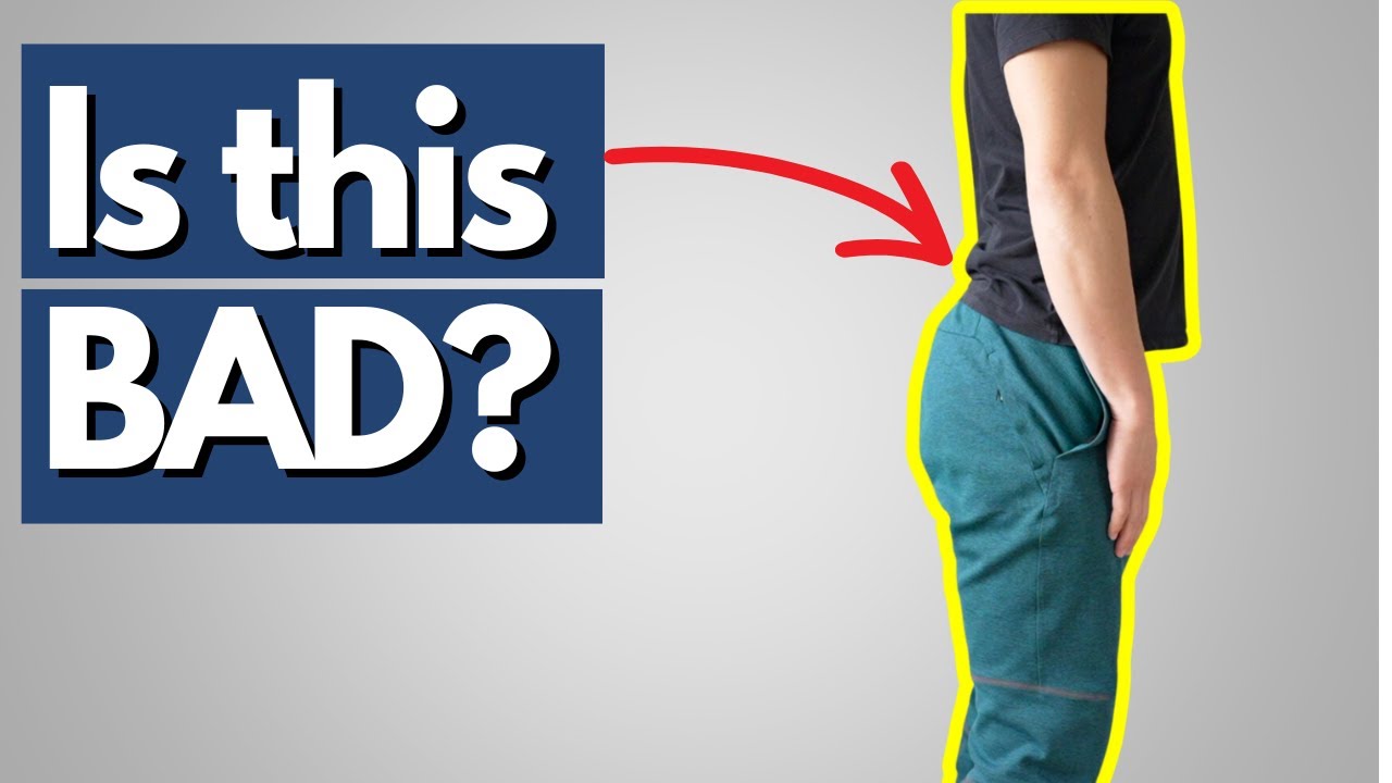 The Real Consequences of Anterior Pelvic Tilt (Not What You Think)