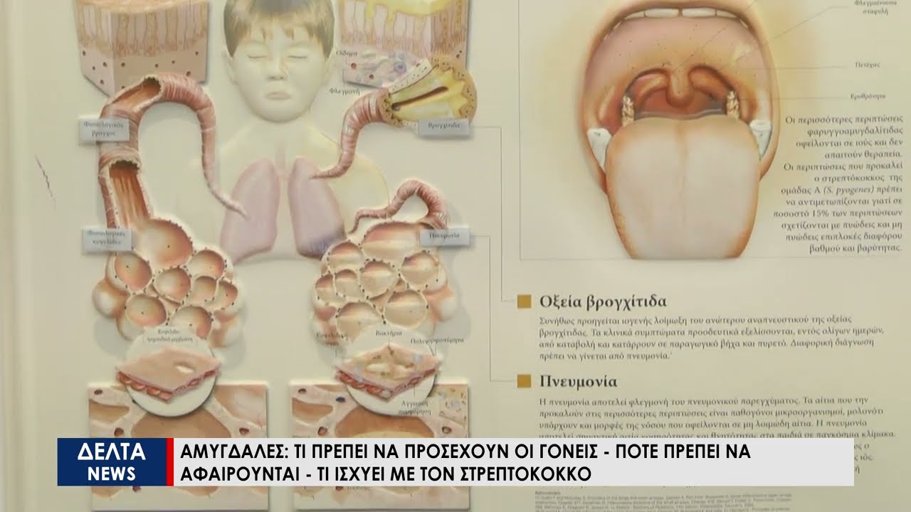 Αμυγδαλές: Πότε πρέπει να αφαιρούνται - Τι συμβαίνει με τον Στρεπτόκκοκο;