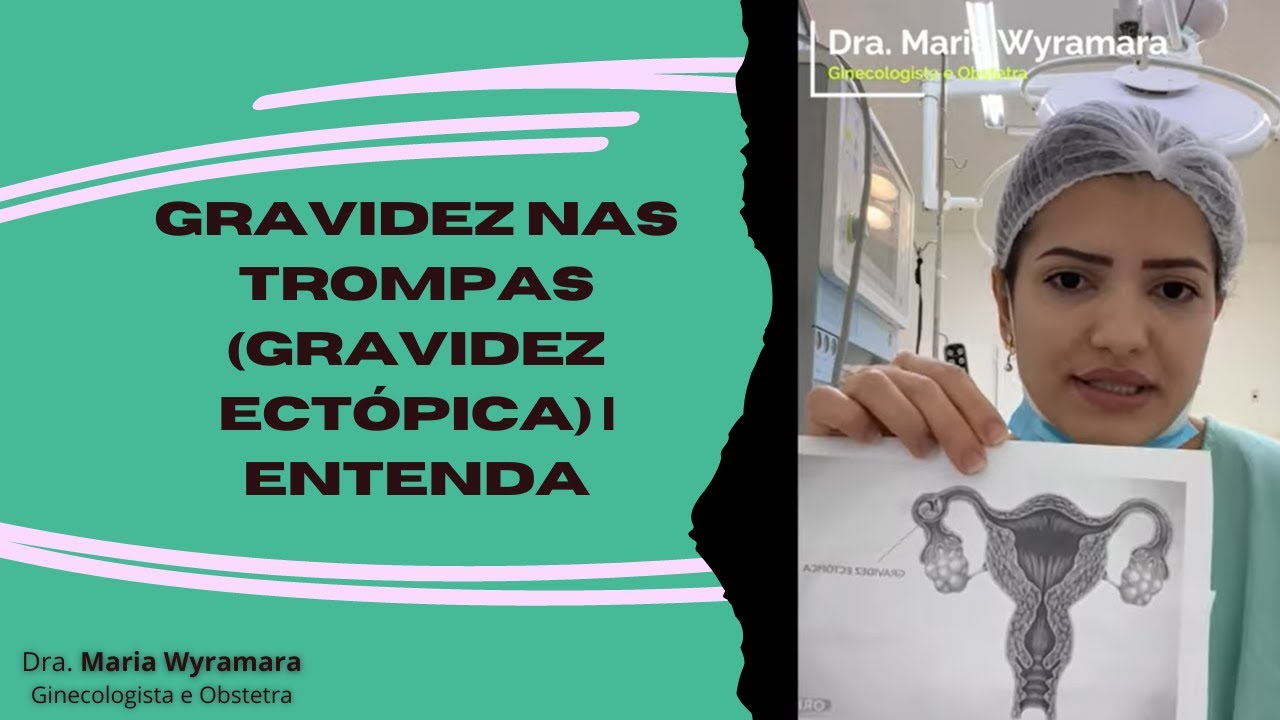 GRAVIDEZ nas Trompas (gravidez ectópica) | Entenda