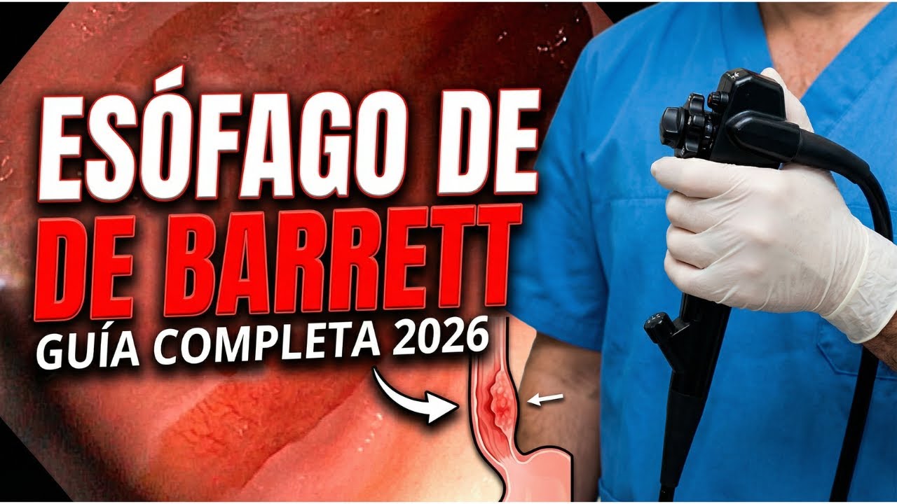 Esófago de Barrett: Qué Es, Síntomas, Diagnóstico y Tratamiento | Guía Médica Completa 2026