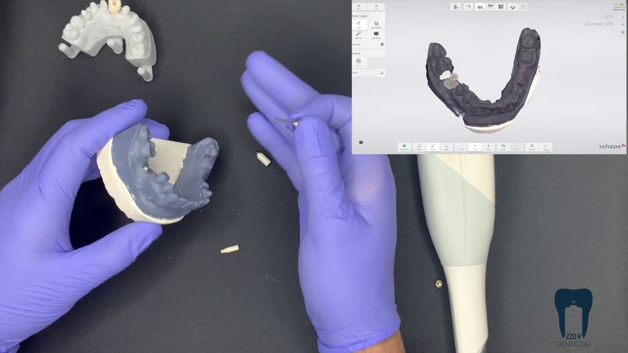 Dijital Ölçü - Diş-İmplant Restorasyonları / Digital Impression Tooth-Implant Supported Restorations