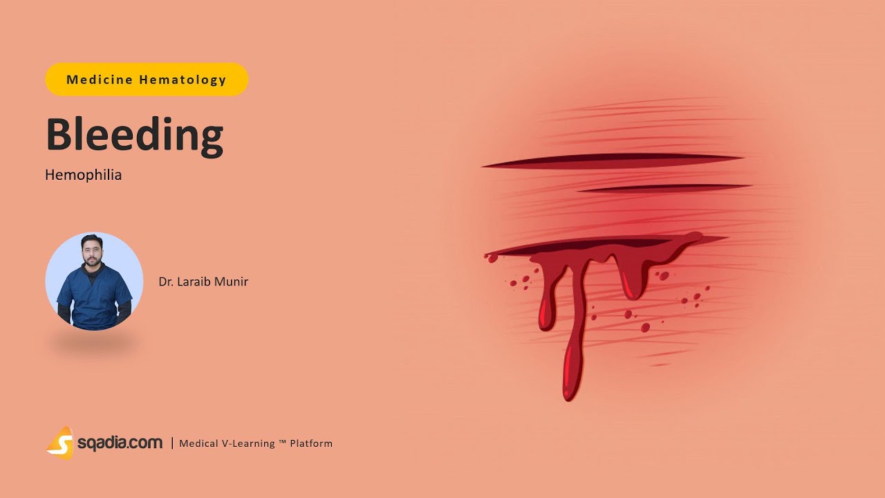 Hemophilia | Bleeding