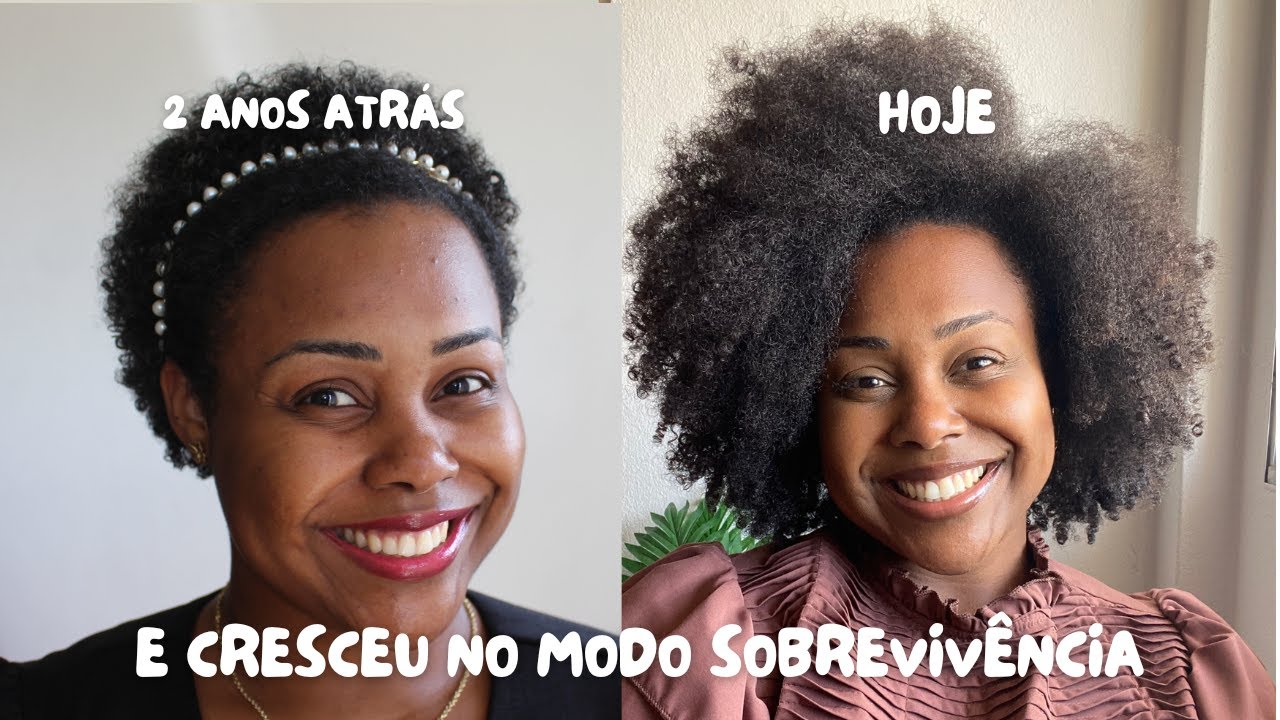 Crescimento capilar quando a vida está um caos: o que realmente funciona.