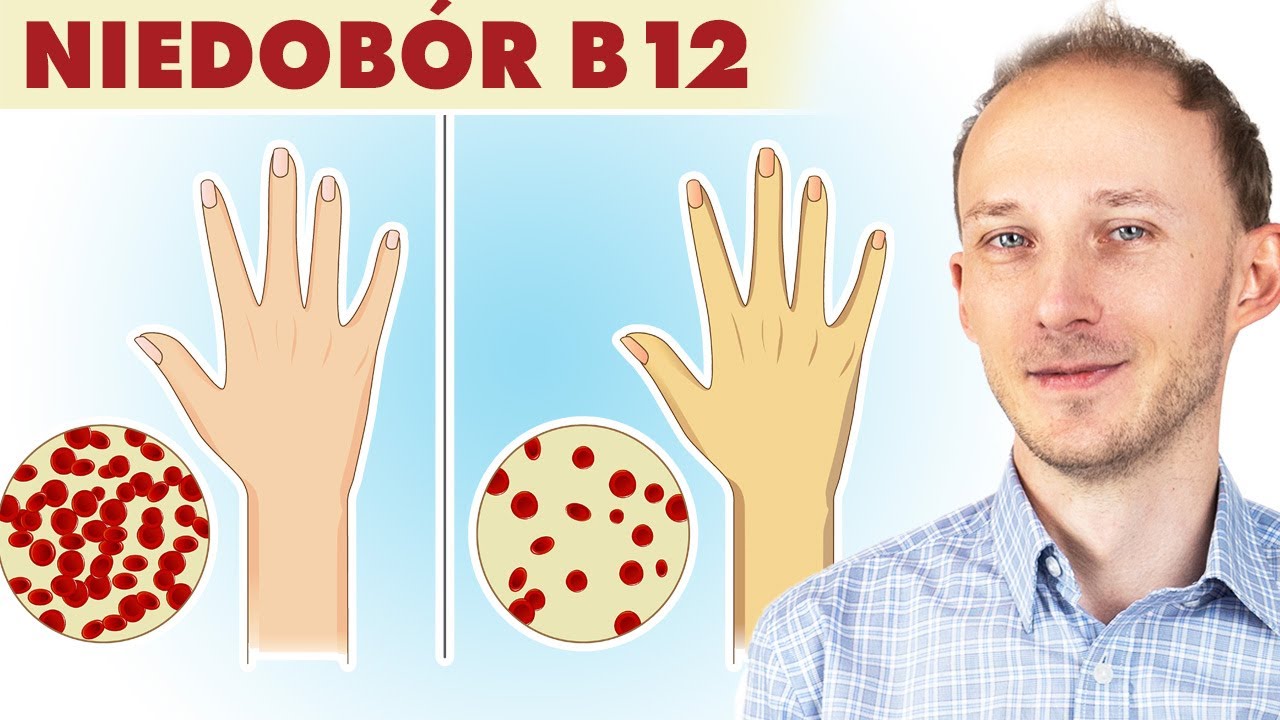 Niedob&oacute;r witaminy B12: ukryta przyczyna chor&oacute;b i dolegliwości! Witamina B12 | Dr Bartek Kulczyński