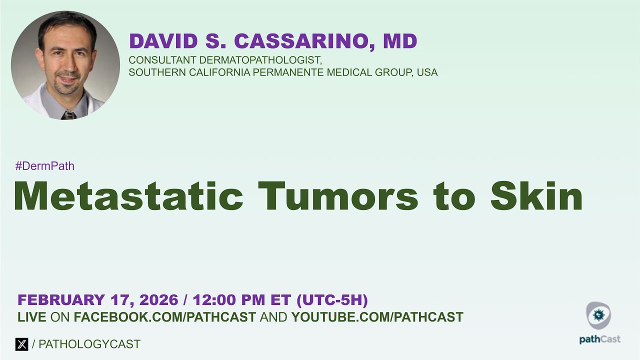 Metastatic Tumors to Skin