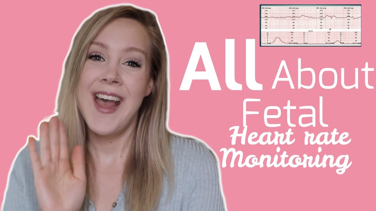 Understanding Fetal Heart Rate Monitoring || Terminology, NSTs, and MORE!