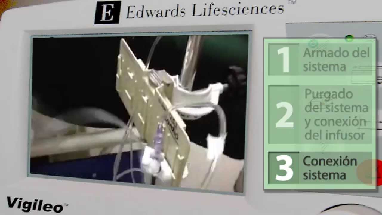 Sistema Vigileo