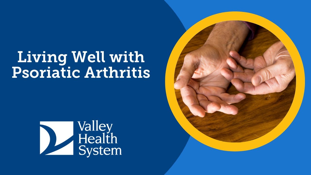 Living Well with Psoriatic Arthritis
