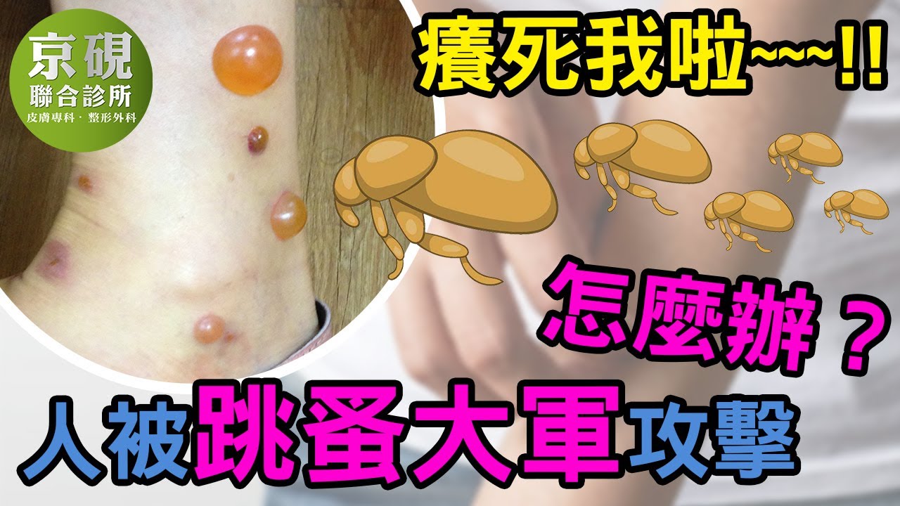 人被跳蚤大軍攻擊怎麼辦？癢死我啦~~~!!【京硯皮膚科診所】