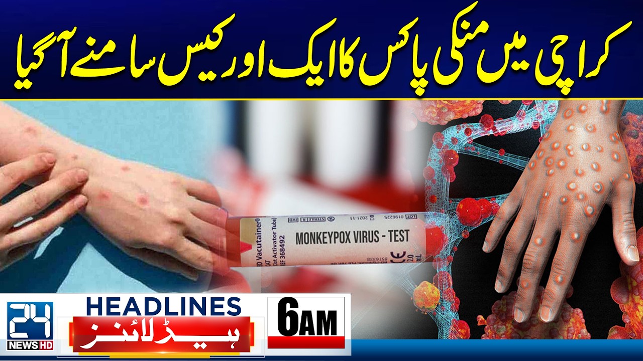 Budget 2026-27 - Another Monkeypox Case Reported in Karachi - Health Alert - 5am News Headlines