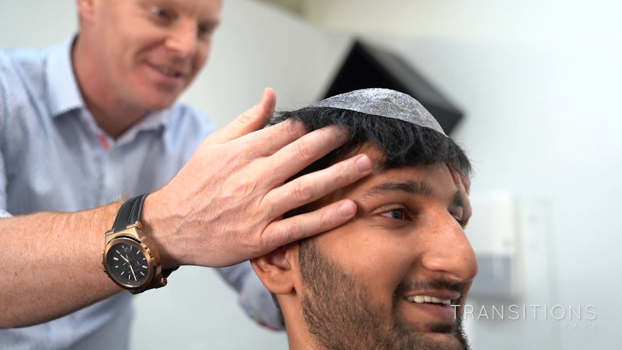 Before & After - Hair System - Non-Surgical Hair Replacement System for Men - Sydney Australia AU/NZ