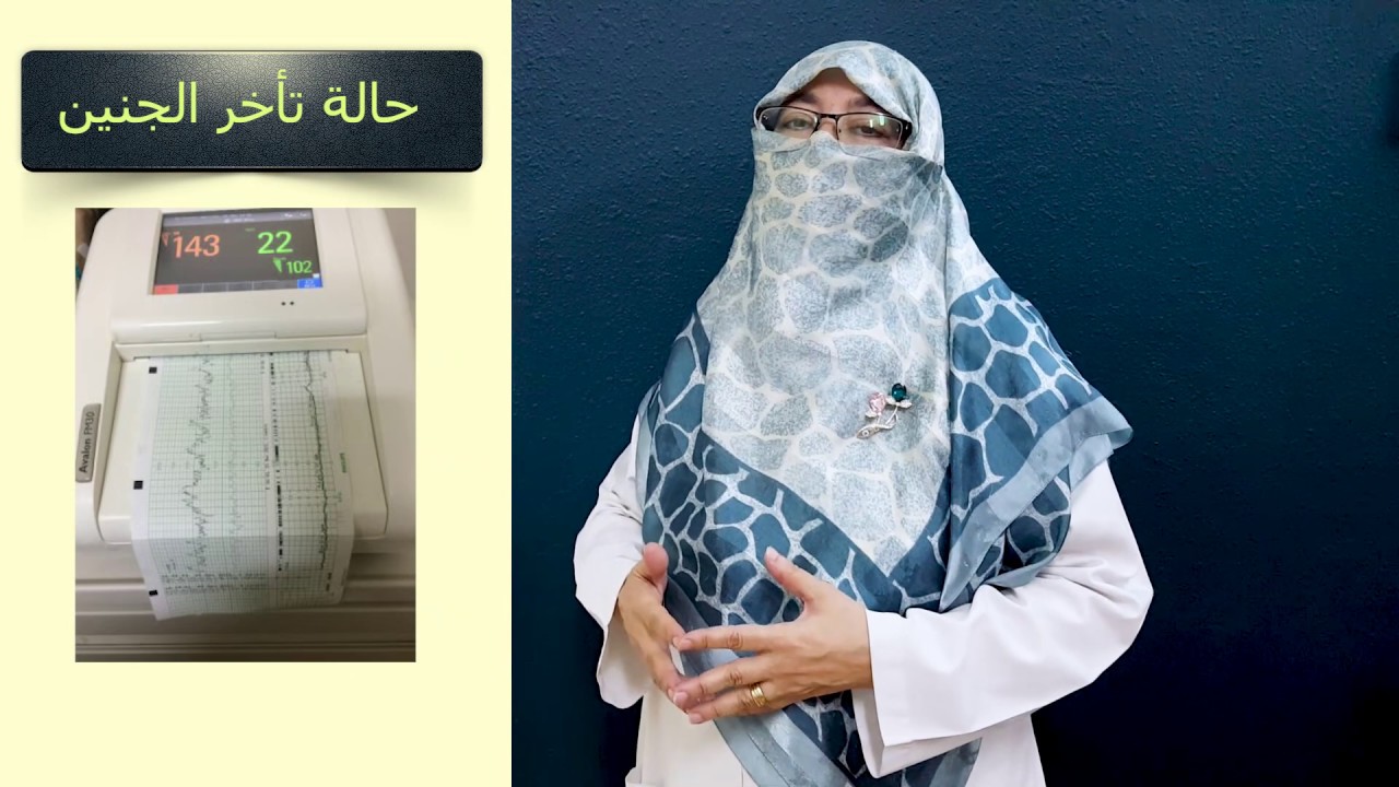 الولادة الطبيعية كيف تكون سهلة في وجود الطلق الصناعي..
د. أمل سعيد.