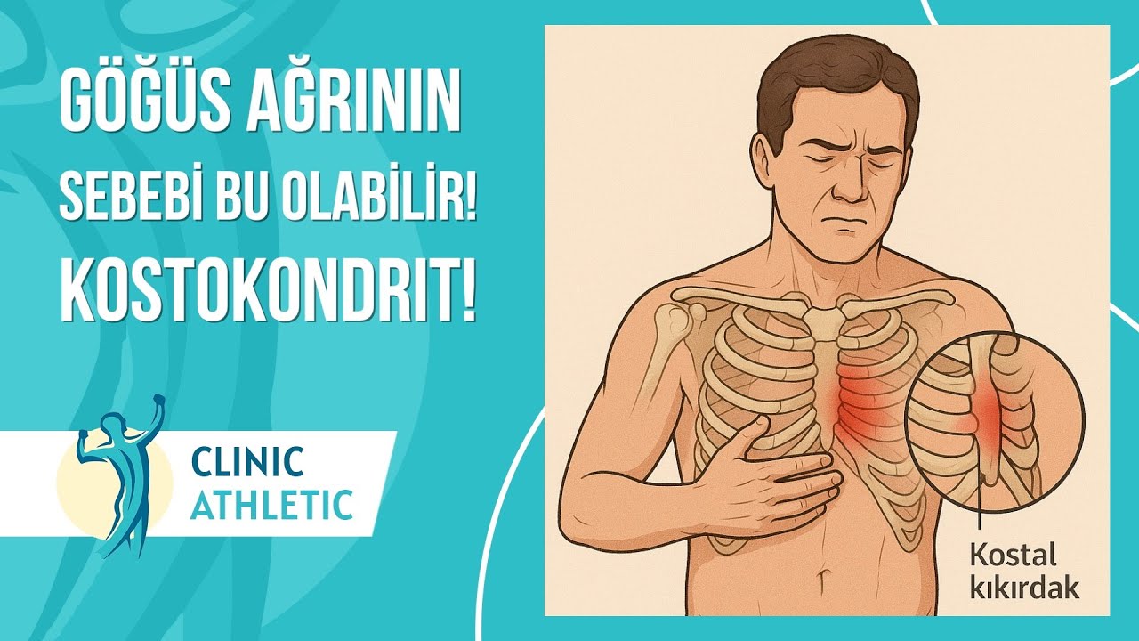 Göğüs Ağrının Sebebi BU OLABİLİR! Kostokondrit Nedir?