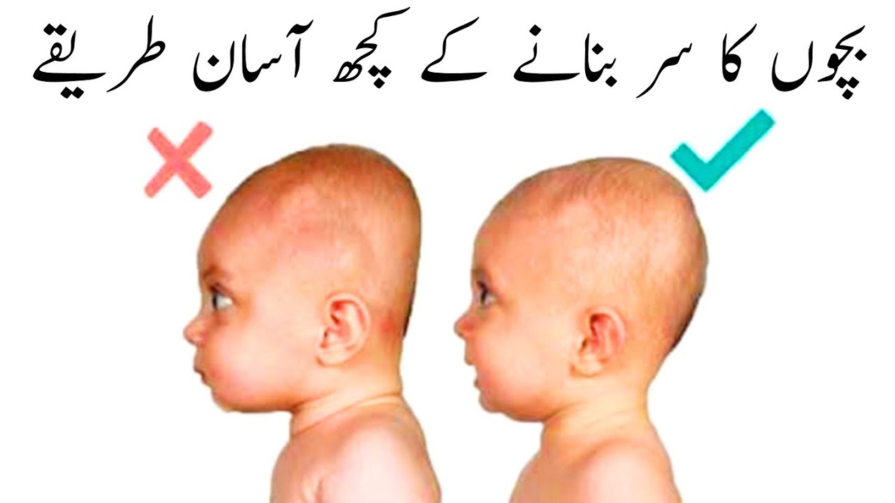 Bachy ka sir bnany ka tareqa | How to shape baby's head | بچے کا سر بنانے کا طریقہ  #baby