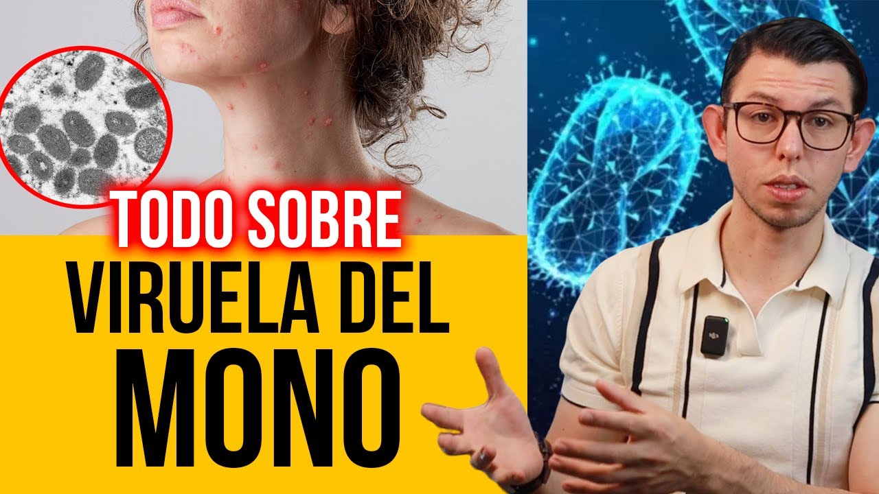 TODO sobre VIRUELA DEL MONO | DrPoloGuerrero