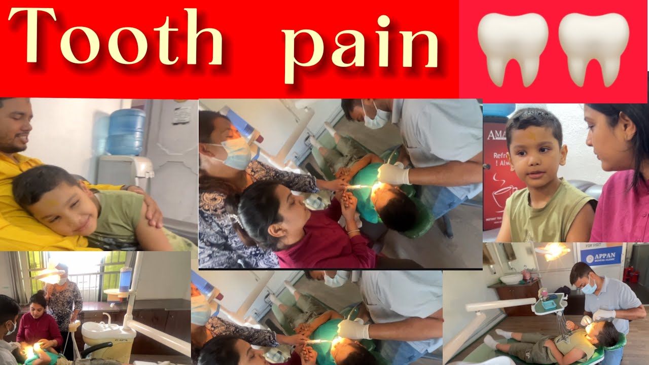 दातको  दुखाईले डेन्टल  सम्म पुर्यायो ा  /Tooth Pain Treatment. Part -1
