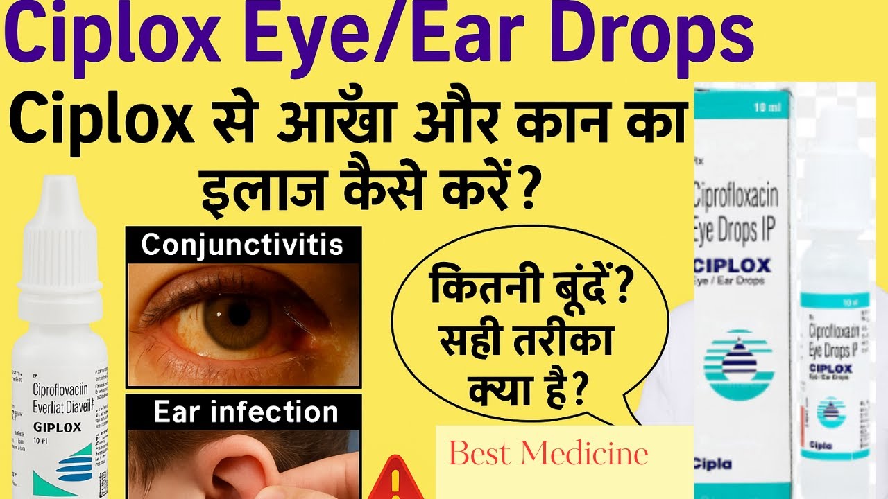 Ciplox Eye & Ear Drops के Uses, Side Effects और Review | Ciprofloxacin कैसे करें इस्तेमाल? हिंदी में