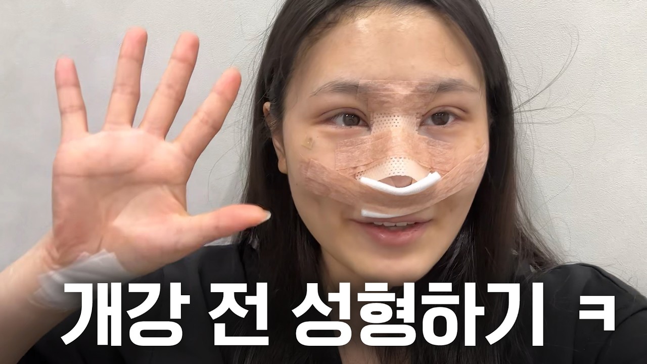 성형하고 학교 갔더니 못 알아봐요😅 눈 &코 첫수술 후기 [경서Vlog]