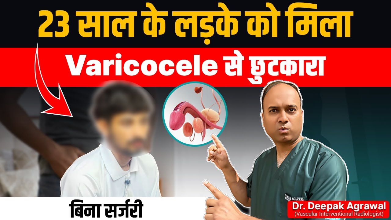 23 साल के लड़के ने Varicocele को हराया बिना सर्जरी! | Varicocele Embolization Patient Story
