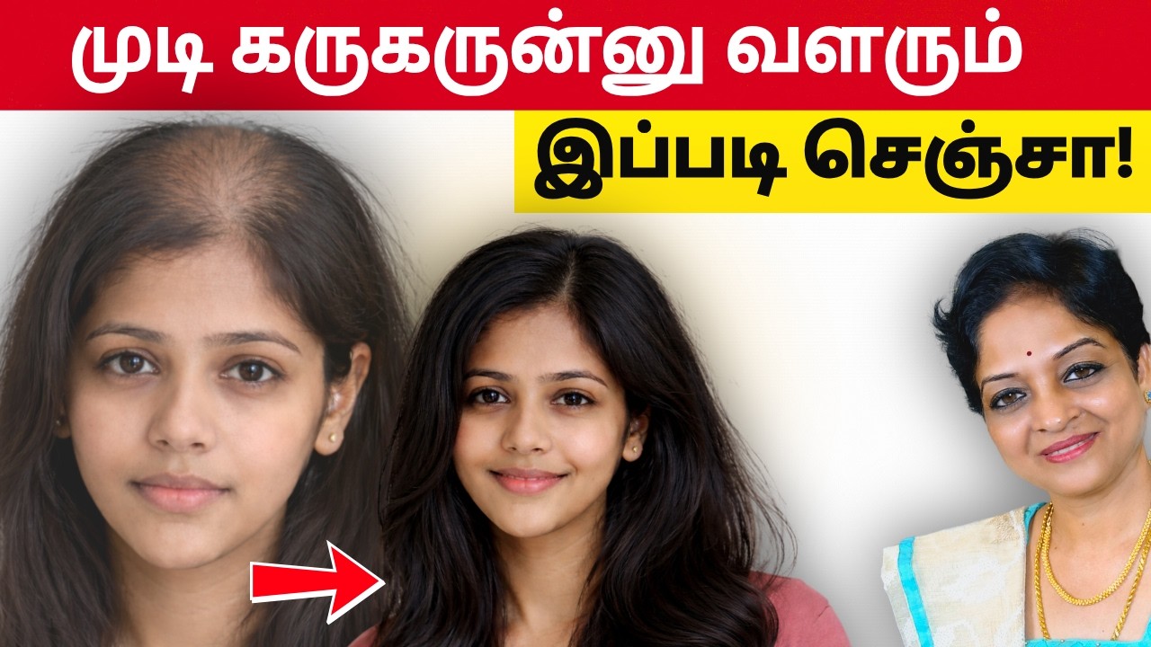 கருகருன்னு முடி வளரும் Costly ட்ரீட்மெண்ட் இல்லாமலேயே! | Health Tips Tamil