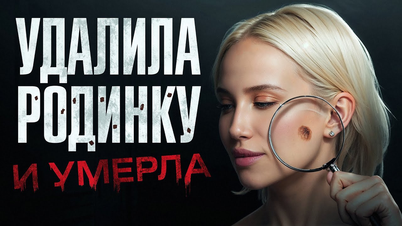 Удаление родинок – все ЗА и ПРОТИВ. Почему вы НЕ удаляете родники?