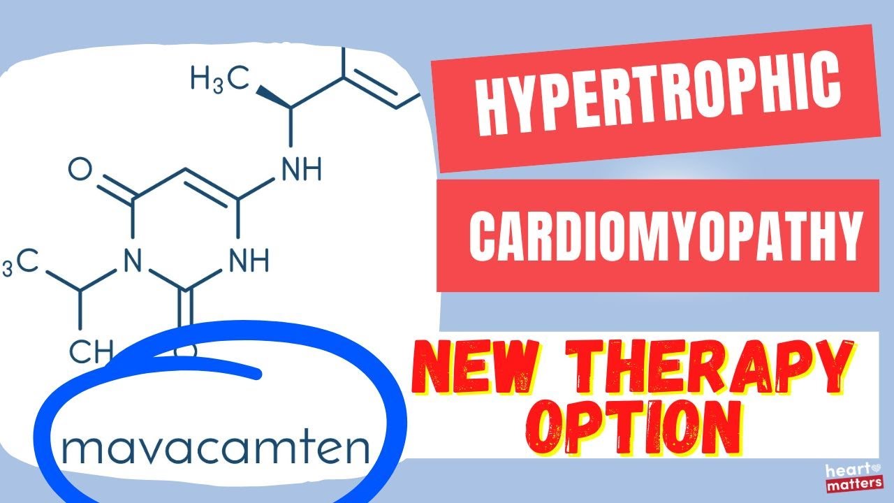 New Treatment Option for Hypertrophic Cardiomyopathy | Mavacamten