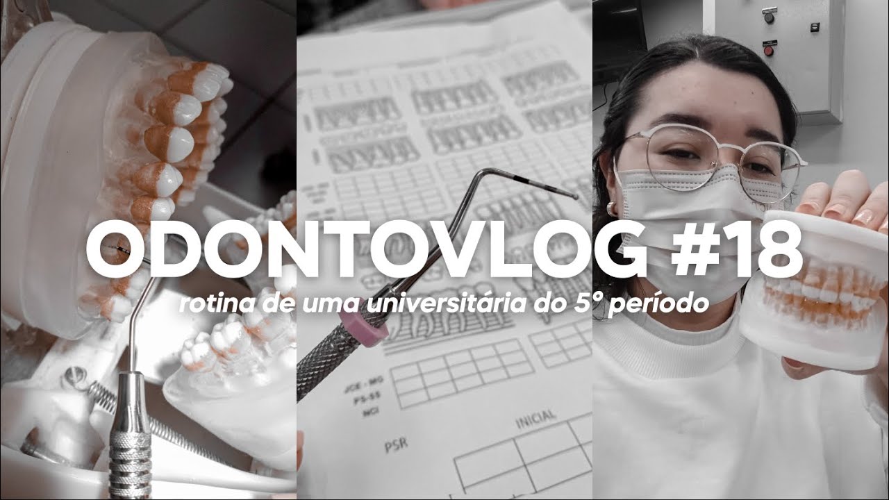 ODONTOVLOG #18: primeira pr&aacute;tica de periodontia | Odonto Energy