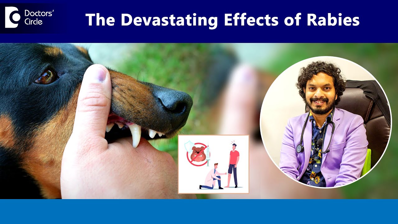 Danger Signs after Dog or Cat bite |Stages of Rabies in Humans- Dr.Leela Mohan PVR | Doctors' Circle