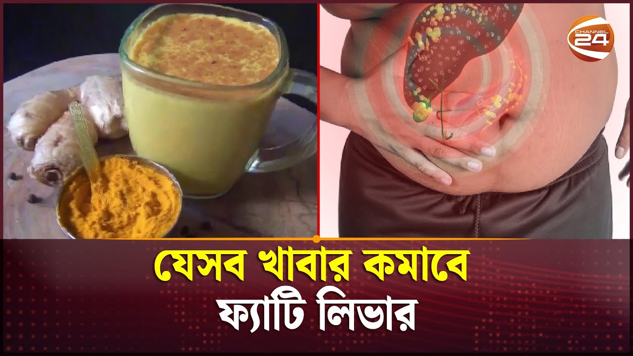 যেসব খাবার কমাবে ফ্যাটি লিভার | Fatty liver | Channel 24