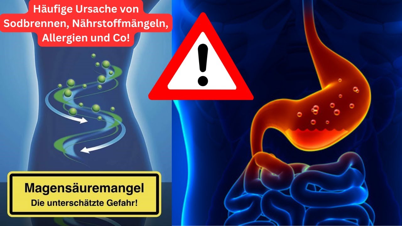 Ein Magensäuremangel hat katastrophale Auswirkungen!