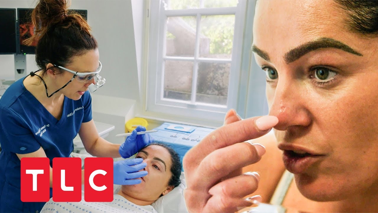 Tumor an der Nase? | Dr. Emma: Hautärztin aus Leidenschaft | TLC Deutschland