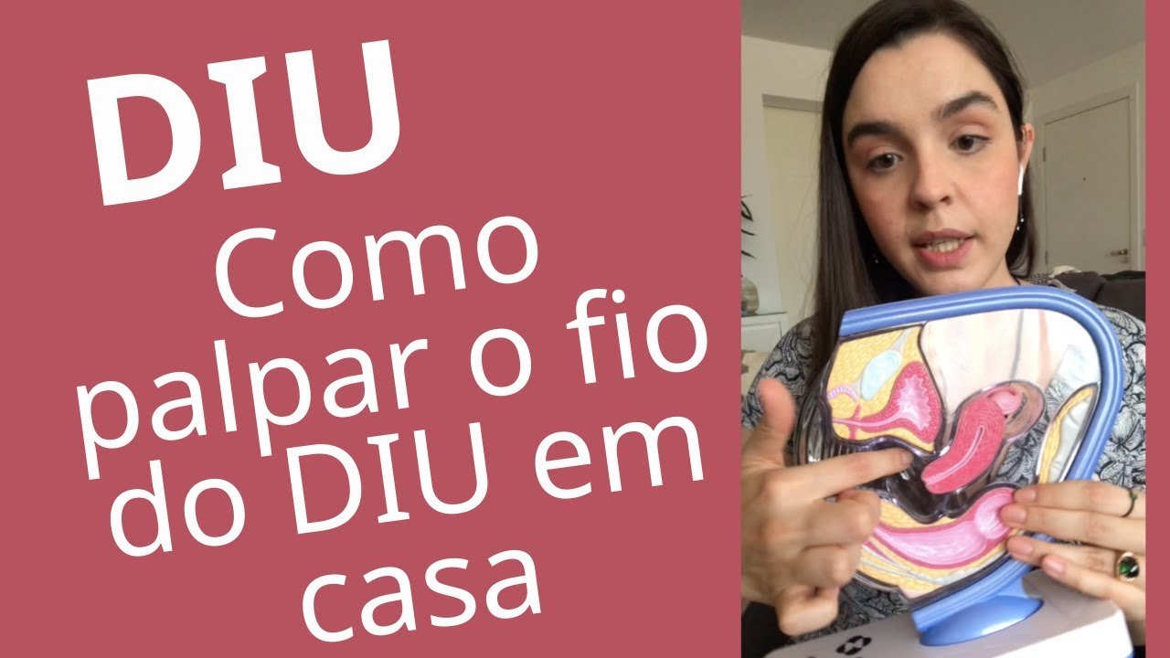 Como palpar o fio do DIU na vagina. DIU de cobre ou hormonal. Anticoncepcional de longa duração