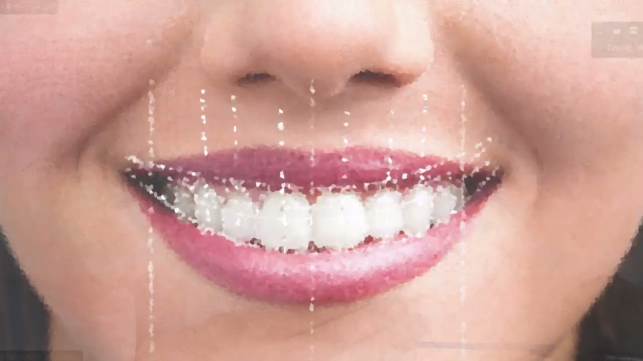 ¡El Secreto de la Finalización Bioprogresiva REVELADO! Arcos que Transforman Sonrisas