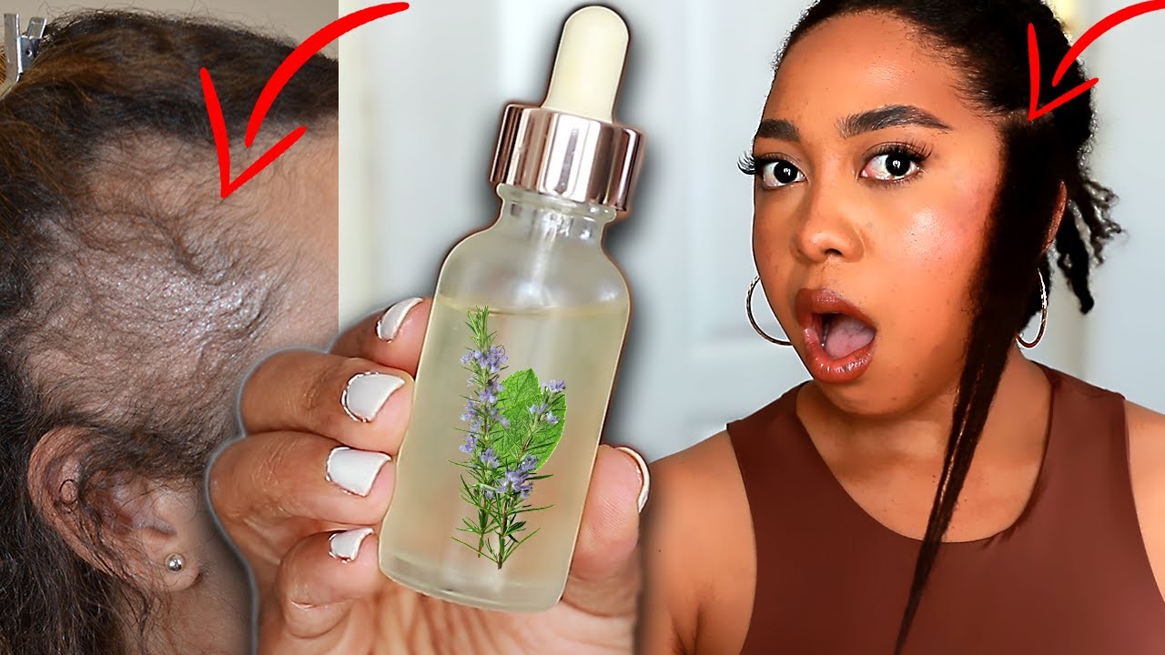 ONLY 3 INGREDIENTS TO GROW YOUR EDGES BACK FAST!