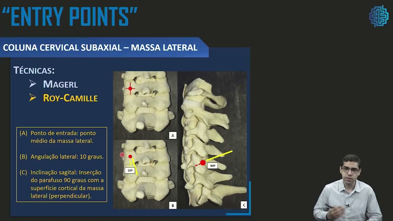 COLUNA CERVICAL - ARTRODESE - ENTRY POINTS  - PARTE 1 (COLUNA CERVICAL)