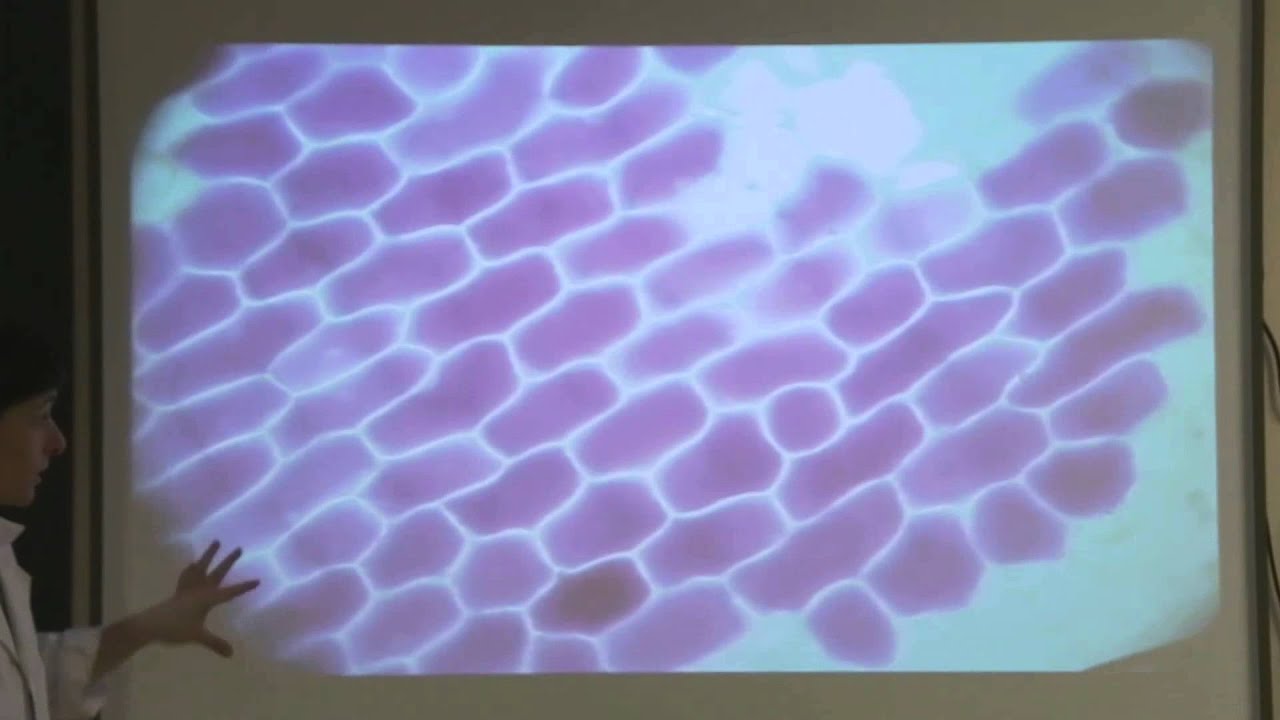 BIOLOGIA   Plazmolízis vizsgálata lilahagymán