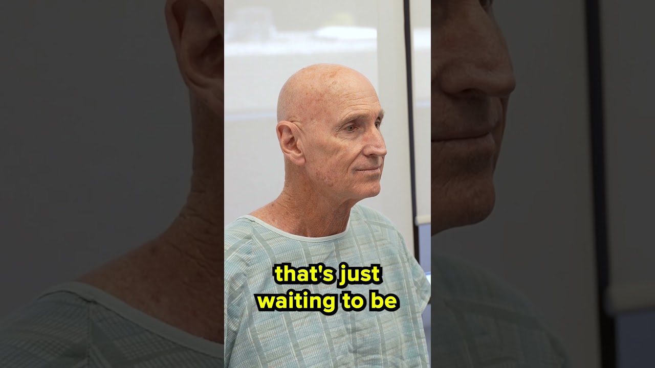 Ideal Facelift and Neck Lift Male Patient Pre Op